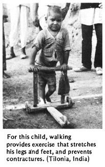  For this child, walking provides exercise that stretches his legs and feet, and prevents contractures. (Tilonia, India)