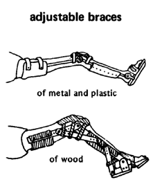 Adjustable braces