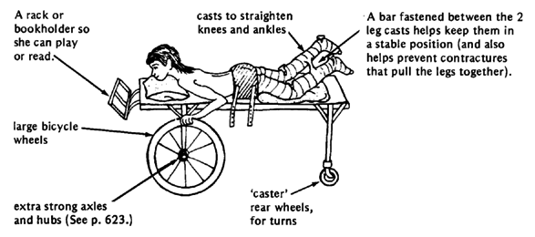 Lift can be made more interesting by using a lying frame on which she can move about.