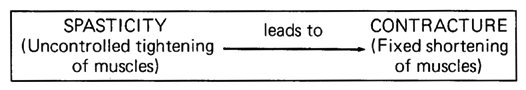 SPASTICITY (Uncontrolled tightening of muscles) leads to CONTRACTURE (Fixed shortening of muscles)
