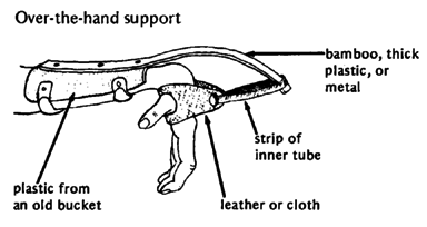 Over-the-hand support.