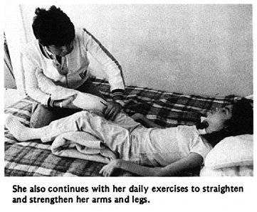 She also continues with her daily exercises to straighten and strengthen her arms and legs.