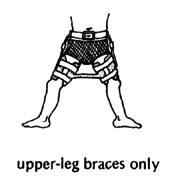 Upper-leg braces only