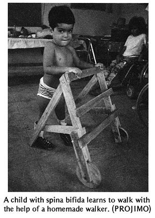 A child with spina bifida learns to walk with the help of a homemade walker. (PROJIMO)