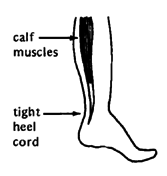 The muscles at the back of the lower leg.