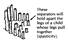 Pole seats like this help a child sit who still lacks balance, or has trouble controlling his position.These separators will hold apart the legs of a child whose legs pull together (spasticity).