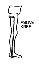 Above knee.