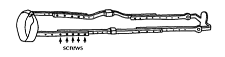 Adjustable braces (screws)