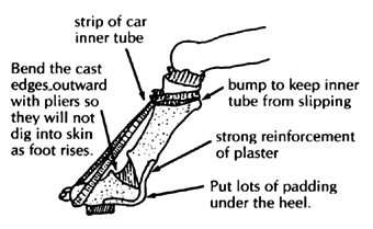 Pulling the foot up without needing frequent cast changes.