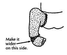 Cut out a wide ring from heel to mid-foot.