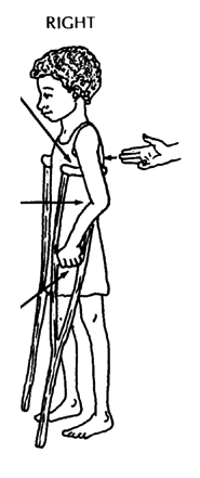 Position of crutch's top, elbow, handgrip.