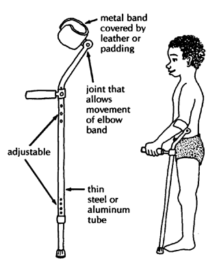 Other elbow crutches (standard adjustable)