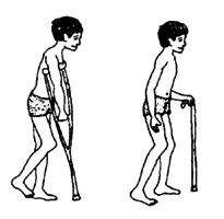 For the child who needs to strengthen a weak or painful leg, a cane makes him use his leg.