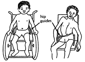 Hip guides