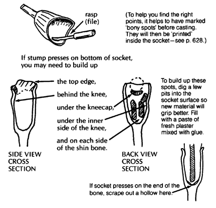 Scrape shallow pits into the socket from the inside, at the points where it presses over bones. (side & back view cross section)