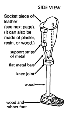 Above-knee limb's side view.