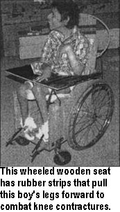 This wheeled wooden seat has rubber strips that pull this boy's legs forward to combat knee contractures.