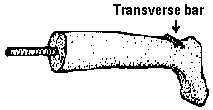 Transverse bar