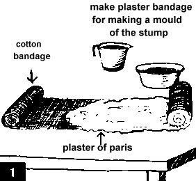 Figure 1. Putting the plaster of paris(POP) on a cotton bandage.